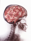 Brain Inside Skull, Artwork on X-ray