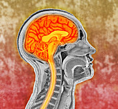 Human Brain, Colorized Illustration