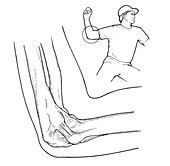 Ulnar Collateral Ligament, Pitcher, Baseball