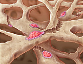 Osteoclasts, illustration