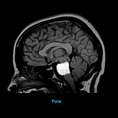 Pons, Sagittal MRI