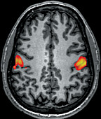 fMRI during Facial Grimacing