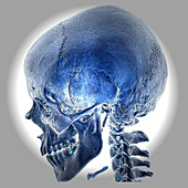 Normal Skull, 3D CT scan