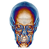 Normal Skull, 3D CT scan