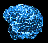 Enhanced 3D Surface Rendering of Brain