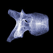 Human Vertebra T5, X-ray