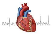 Atrial Flutter with EKG, Illustration