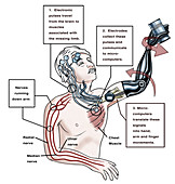 Prosthetic Robotic Arm, Illustration