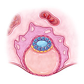 Blastocyst Implantation, Illustration