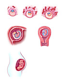 Embryo Implantation, Illustration