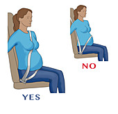 Seat Belt Safety for Pregnant Women, Illustration