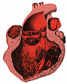 Heart Anatomy, Carl von Rokitansky, 1875