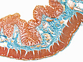 Colon, full thickness, LM