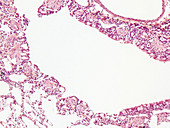 Lung parenchyma, human-B1, LM