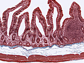 Jejunum, intestinal villi, lacteals, LM