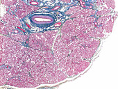 Sublingual gland, human, LM