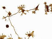 Neurons in primary cell culture, LM