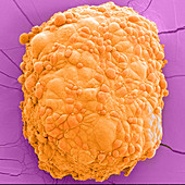 Mesothelioma Spheroid, SEM