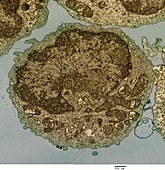 Human B Lymphocyte, TEM