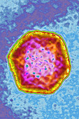 Enterovirus, TEM