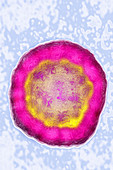 Hepatitis B virus, TEM