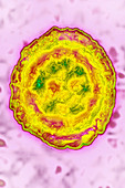 Herpes Simplex Virus 1, TEM