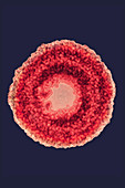 Herpes Simplex Virus 3, TEM