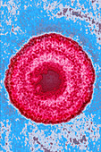 Herpes Simplex Virus 3, TEM