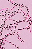 Bacillus anthracis, LM