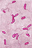 Vibrio cholera bacilli, LM