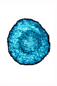 Herpes Simplex Virus 4, TEM