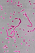 Haemophilus influenzae, LM