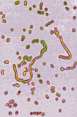 Haemophilus influenzae, LM