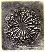 Circlet of Hooks on Scolex, Early Photomicrograph