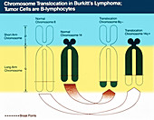 Burkitt's Lymphoma, Chromosome Diagram