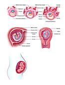 Embryo Implantation, Illustration