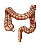 Healthy Large Intestine, Illustration