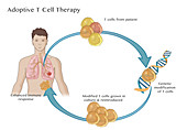 Adoptive T cell Therapy