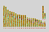 Human karyotype