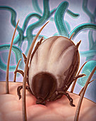 Lyme Disease, Illustration