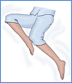 Restless Leg Syndrome, Illustration