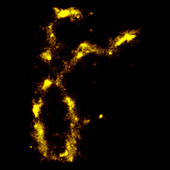 Human chromosome, photo localization microscopy