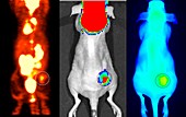Multimodal cancer imaging with nanoparticles