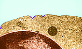 Endocytosis, TEM