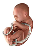 Foetus, illustration
