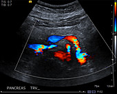 Normal pancreas, ultrasound