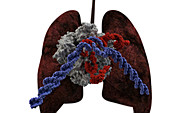 Lung Cancer Treatment, CRISPR-Cas9