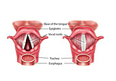 Anatomy of the Larynx, illustration