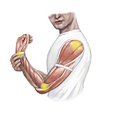 Joint Pain, illustration