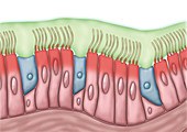 Cilia with Infected Mucus, illustration